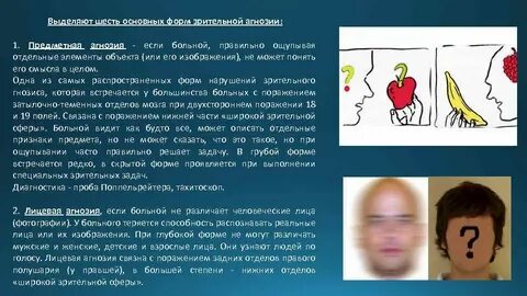Соматоагнозия
