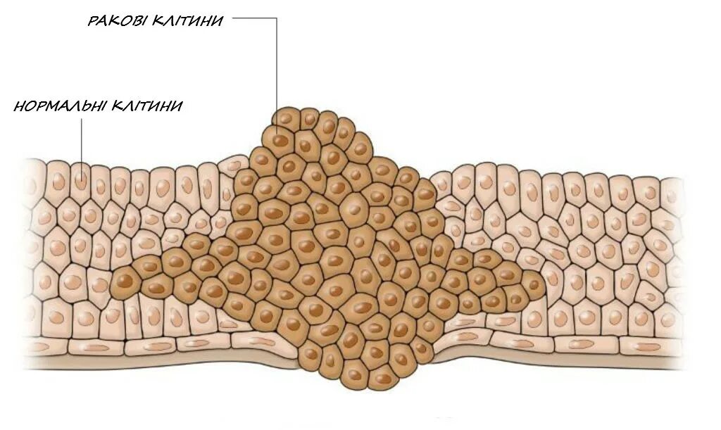 Структура опухолевой клетки. Нормальная клетка и раковая. Деление раковых клеток. Процесс деления раковых клеток. Рака така