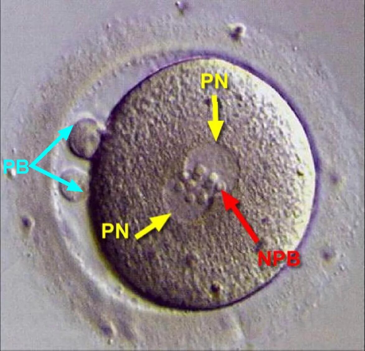 После оплодотворения яйцеклетки и первых. Яйцеклетка. Яйцеклетка в микроскопе. Яйцеклетка под микроскопом. Неоплодотворенная яйцеклетка.