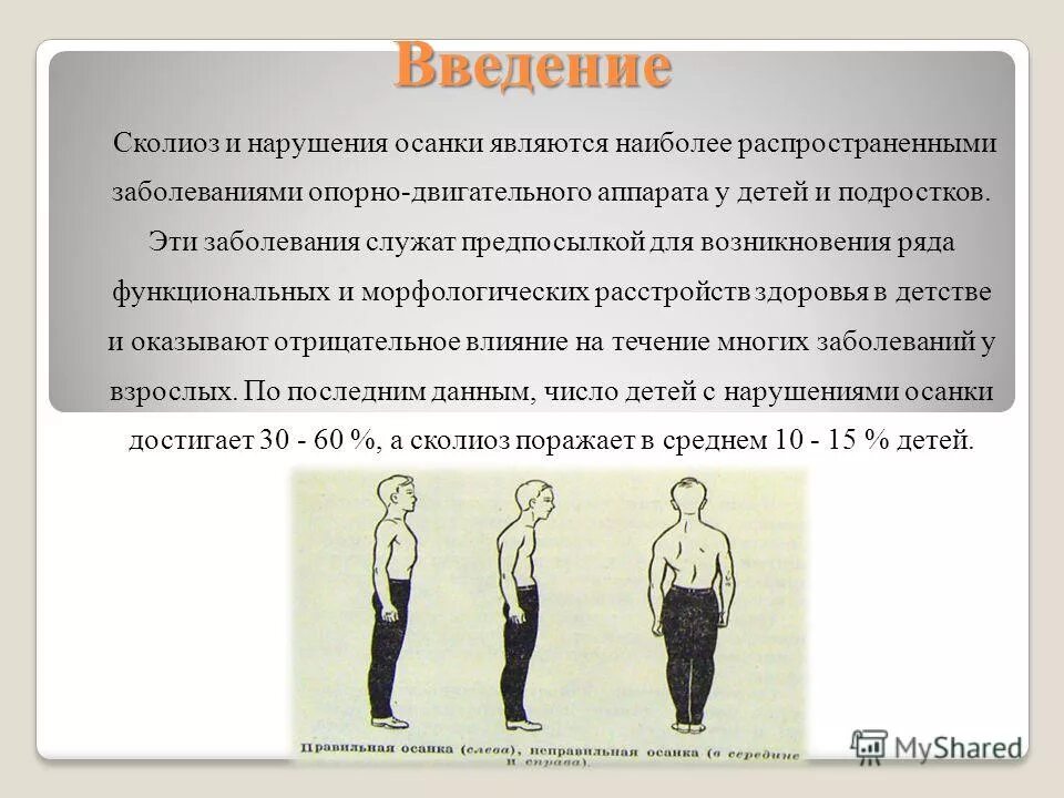 Осанка профилактика нарушения осанки. Правильная осанка. Важность правильной осанки. Реферат на тему нарушение осанки. Презентация на тему осанка.