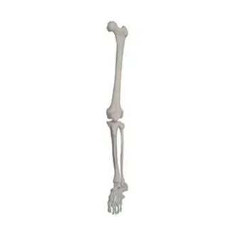 Arm n leg