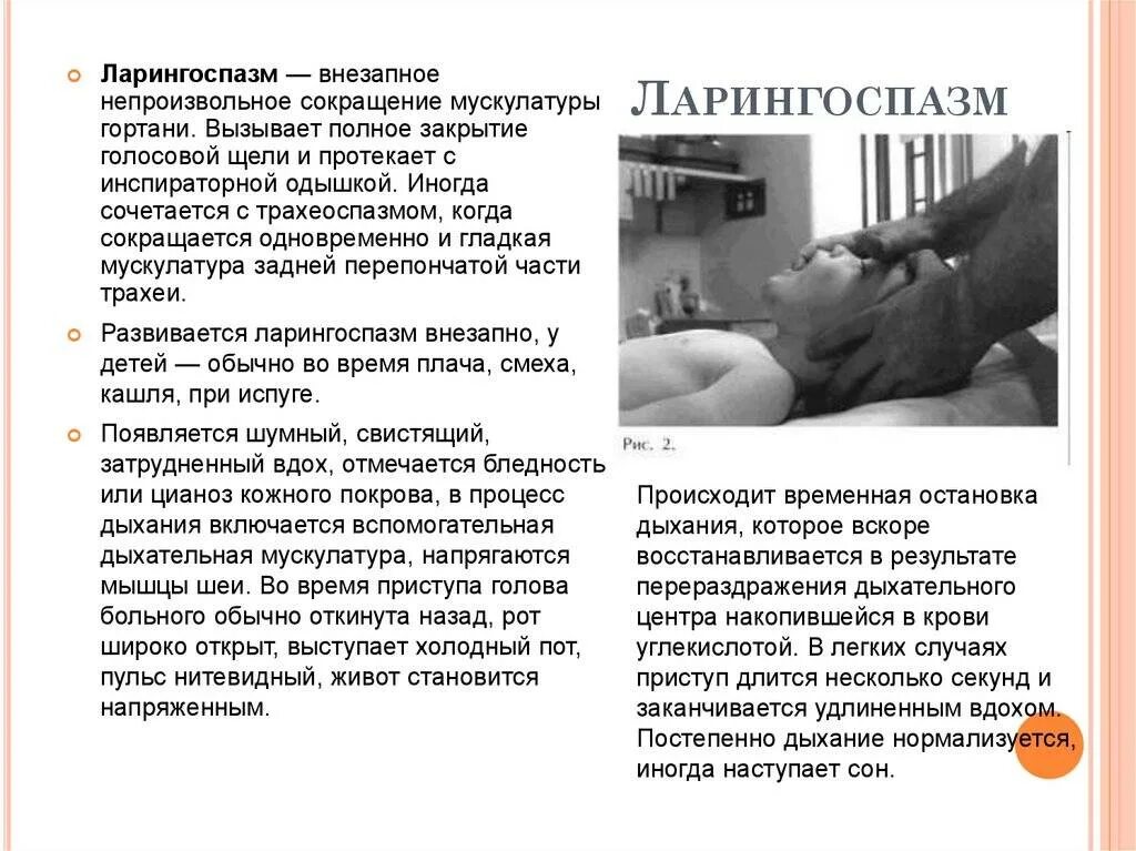 Ларингоспазм у взрослых симптомы и лечение причины. Причина развития ларингоспазма у детей. симптомы при ларингоспазме.