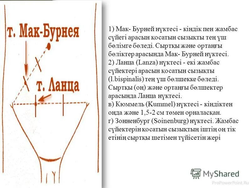 Точка мак бурнея при аппендиците. Проекция червеобразного отростка. Проекция червеобразного отростка. Точка ланца и мак бурнея. Точка мак бурнея при аппендиците.