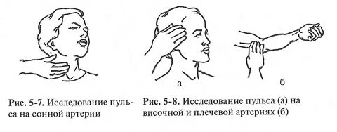 Подсчет частоты сердечных сокращений метод