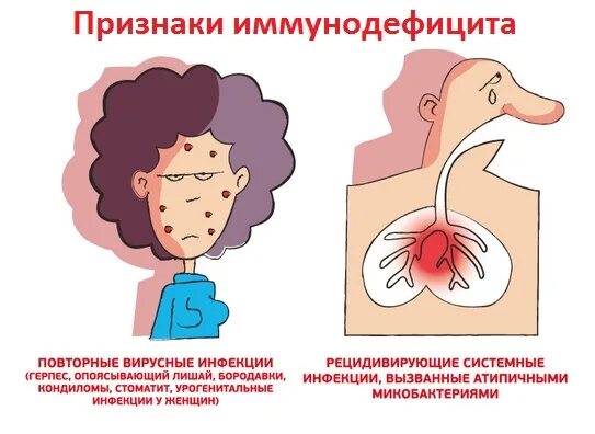 Врожденное иммунодефицитное заболевание. Болезни вторичного иммунодефицита. Общая вариабельная иммунная недостаточность иммунология. 12 настораживающих признаков первичного иммунодефицита у детей. Дефицит иммунитета.
