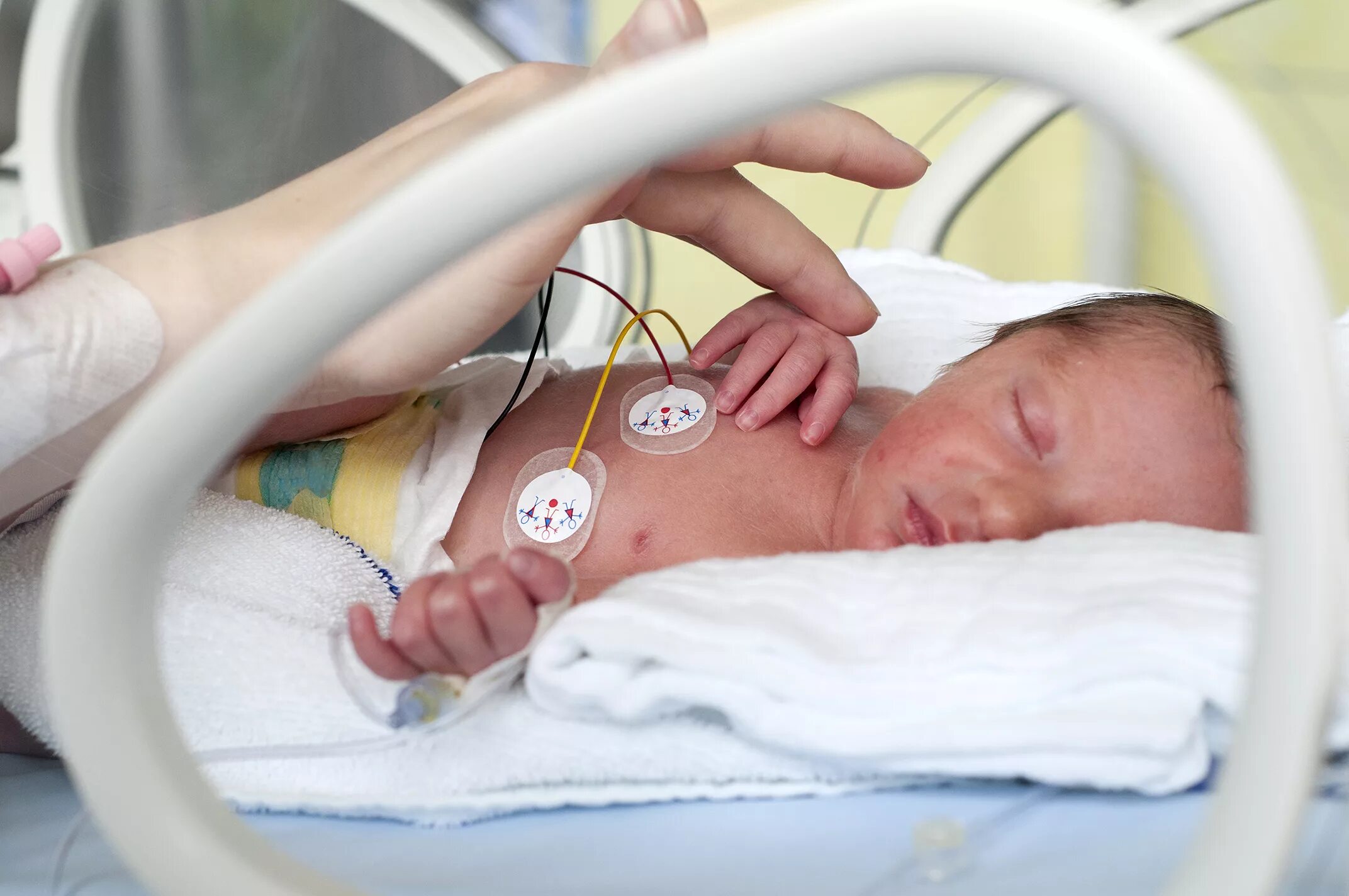 Семимесячный ребенок температуре. Недоношенный новорожденный. Новорожденный в кбвезе. Недоношенные в кювезах.