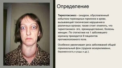 Синдром барбара сэя фото и описание
