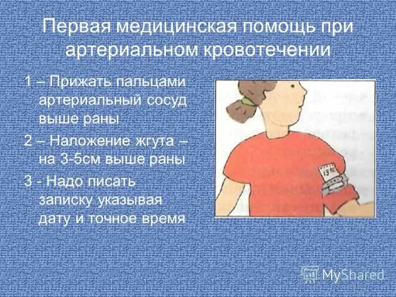 Первая помощь при артериальных повреждениях. Оказание первой помощи при артериальном кровотечении. артериальное кровотечение пмп. пмм при артериальном кровотечении. первая медицинская помощь при артериальном кровотечении.