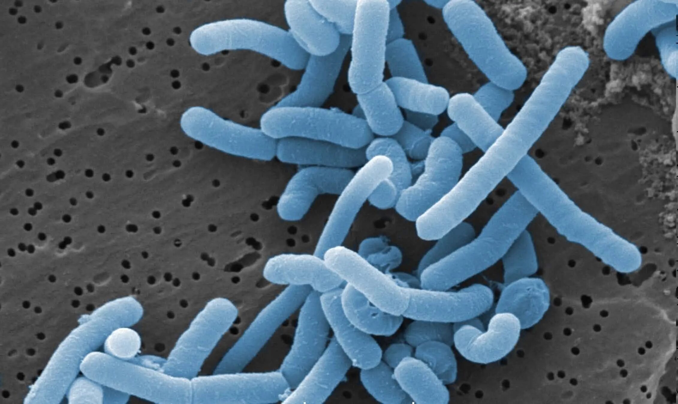Рубцовые бактерии. Молочнокислые бактерии лактобациллы. Lactobacillus – (молочнокислые палочки) -. Молочнокислые бактерии (Lactobacillus plantarum). Lactobacillus Acidophilus в микроскопе.
