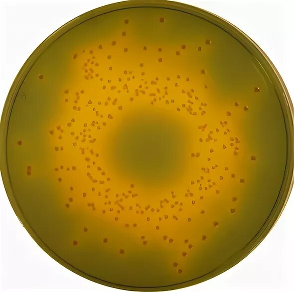 Цитрат симмонса сальмонелла. Salmonella enteritidis - xld-агар. Среда лаб. 6). Цитратный агар кристенсена.