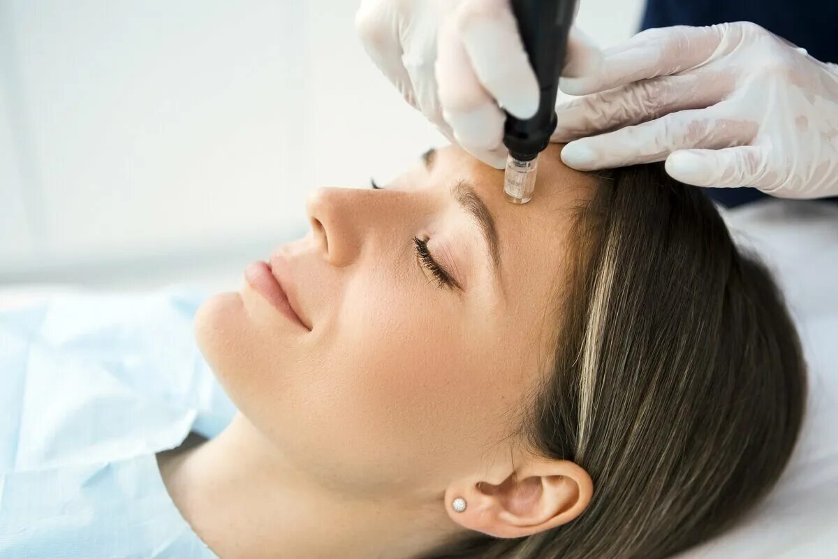 Какие процедуры для лица в 35. Dermapen. фракционная мезотерапия. микронидлинг. фракционная мезотерапия для лица.