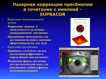 Как лечить пресбиопию глаз