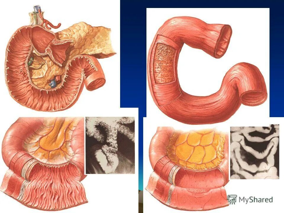 Трубчатый орган 5. Трубчатые органы. Трубчатые органы пищеварительной системы. Пищеварительные органы трубчатые и паренхиматозные. Карточки по анатомии Спланхнология.