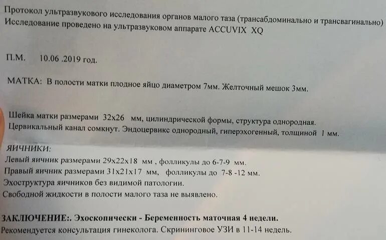 Узи малого таза трансвагинально. Описание узи органов малого таза у женщин в норме. Узи малого таза может показать беременность. Заключение узи малого таза. Узи малого таза беременность на ранних сроках.