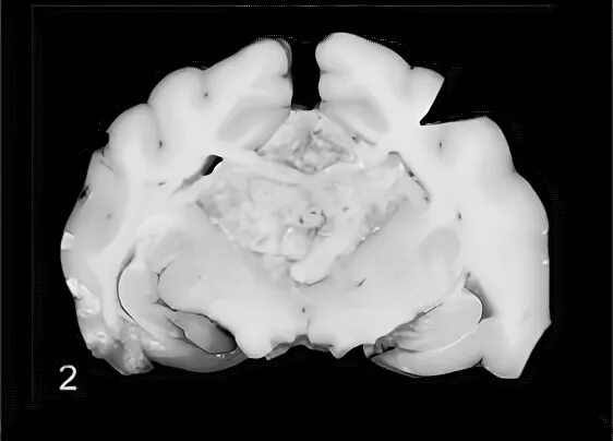 Опухоль мозга у собак. Опухоль головного мозга у собак.