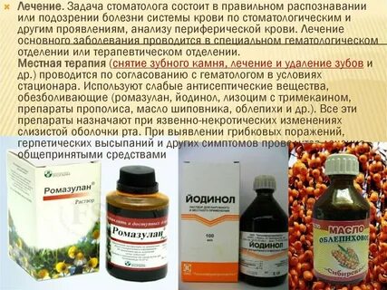 Воспаление полости рта препараты