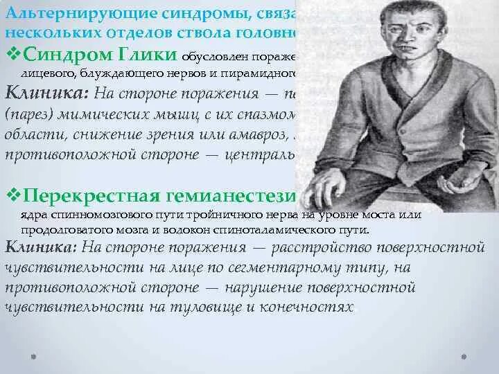 Оптико пирамидный синдром. Оптико пирамидный синдром