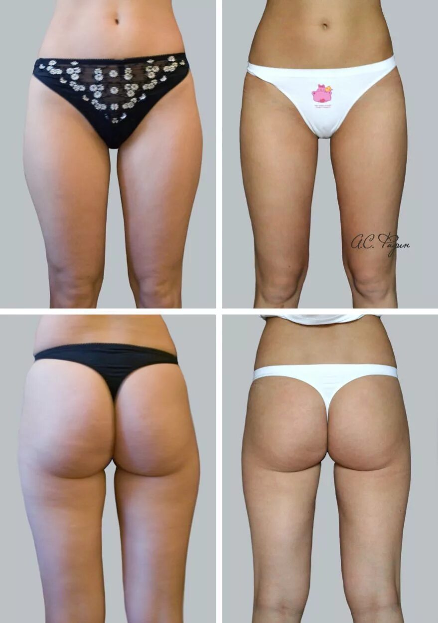 галифе отзывы