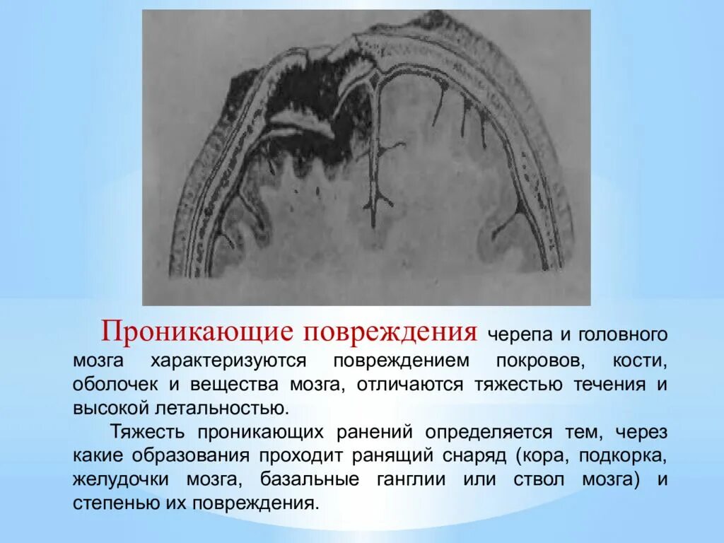 Череп разрыв. ЧМТ повреждения оболочек мозга. Мозговые оболочки при проникающем ЧМТ. Открытая ЧМТ проникающее ранение черепа.