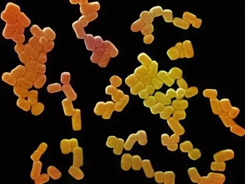 Клостридии диффициле в кале. Клостридии перфрингенс. clostridium perfringens антибиотики. клостридия перфрингенс споры. клостридиум перфрингенс иммунитет.