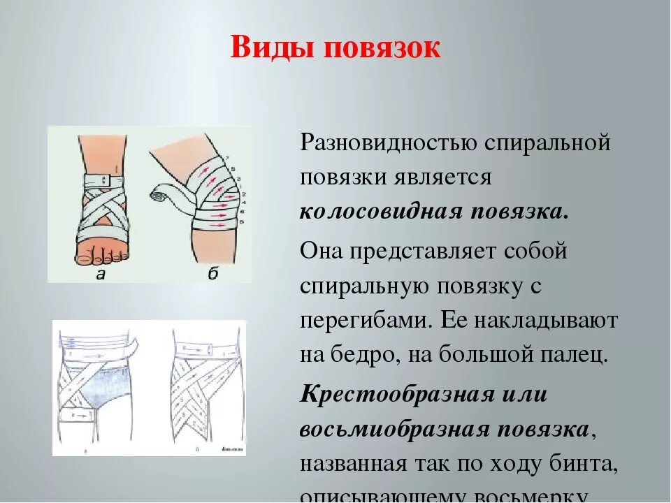 Способы наложения повязок при кровотечении. Виды повязок. Типы наложения повязок. Методы наложения повязок. Виды накладывания повязок.