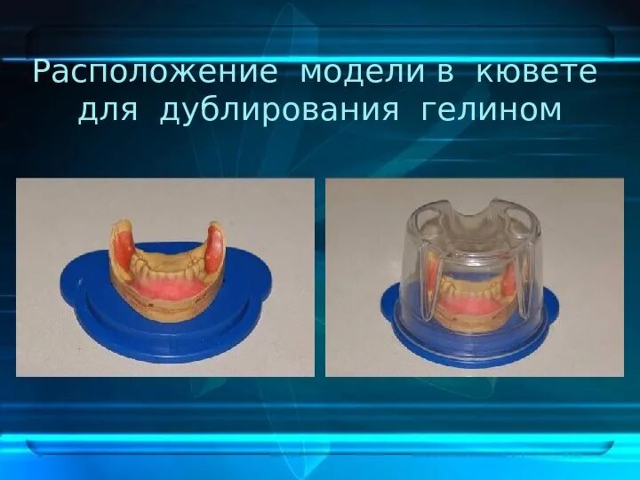 Дублирование определение. Подготовка модели к дублированию. подготовка гипсовой модели к дублированию. дублирование модели. дублирование гелином.