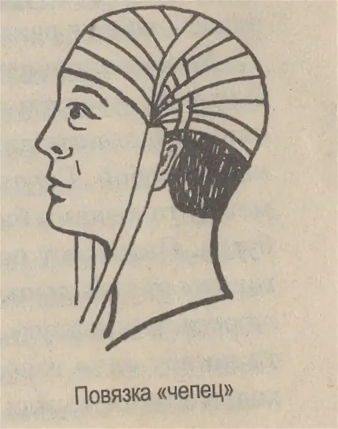 Алгоритм чепца