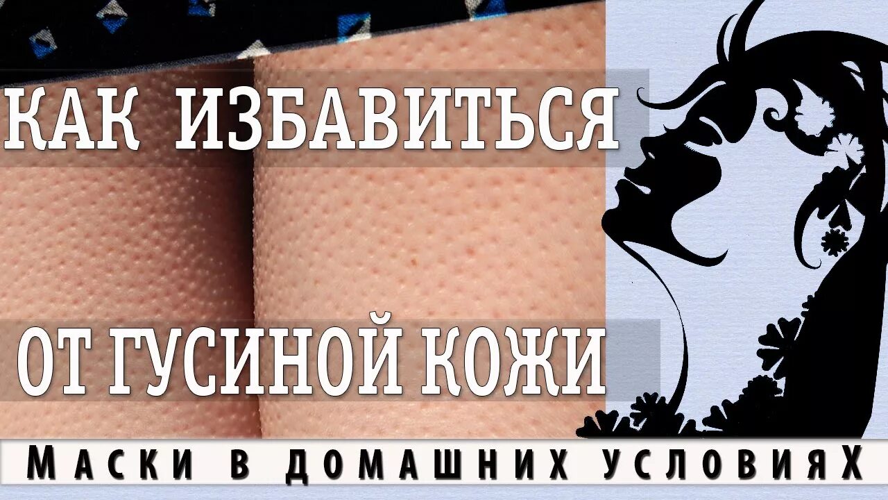 Против гусиной кожи. Средства для гусиной кожи. препараты от гусиной кожи. средство от гусиной кожи на ногах.
