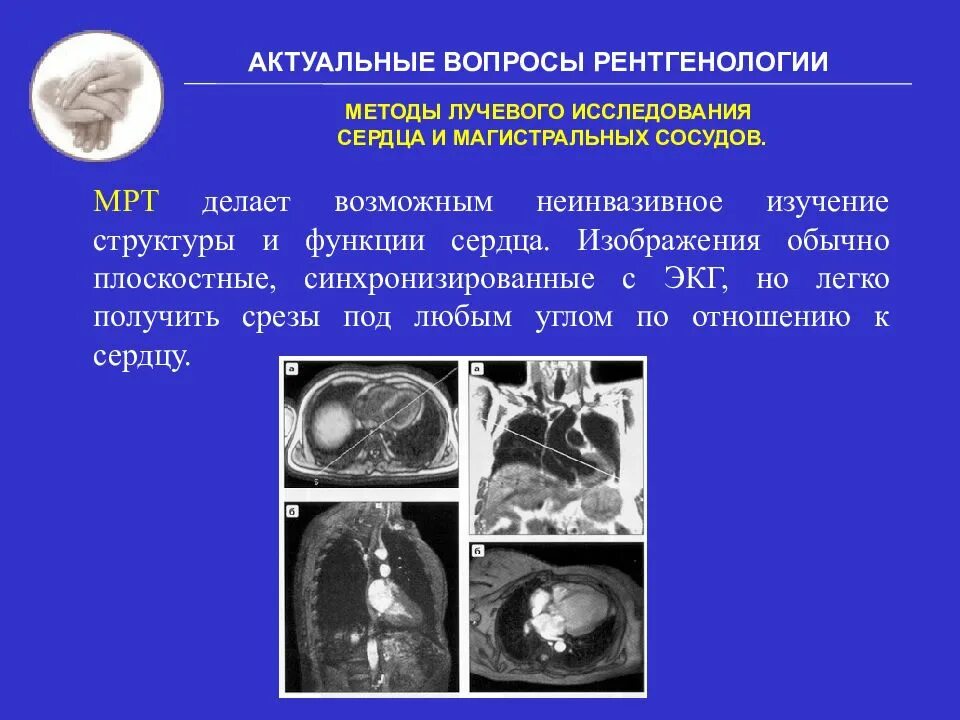 Метод радиальных. Лучевые методы исследования сердца. методы лучевого исследования сердца и сосудов. лучевые методы исследования сосудов. метод обследования сердца.