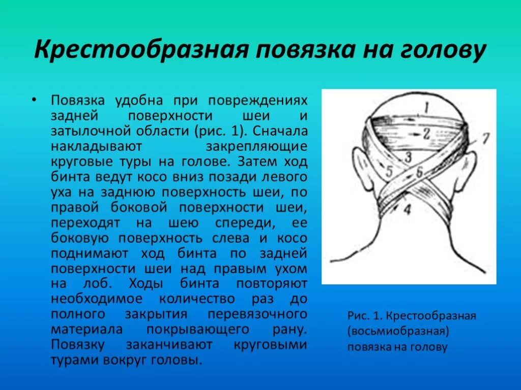 Крестообразная повязка на затылок и шею. Восьмиобразная повязка на затылок и шею. Наложение крестообразной повязки на затылок. Крестообразная повязка на затылок и заднюю поверхность шеи.. Крестообразная на затылок