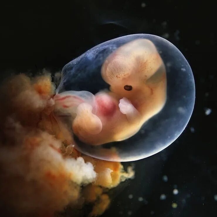 как выглядит плод 7 недель фото