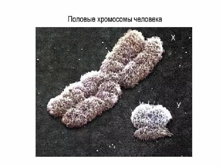 Половые хромосомы человека. Генетическая структура половых хромосом. Строение половых хромосом. Половые хромосомы под микроскопом.