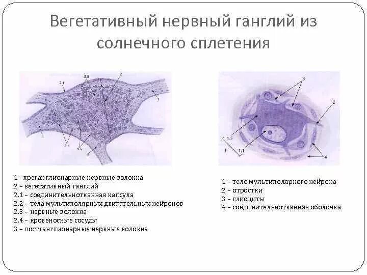 Строение нервного узла. Строение спинномозгового ганглия гистология. Строение вегетативного ганглия гистология. Строение вегетативных ганглиев гистология. Нервные ганглии гистология строение.