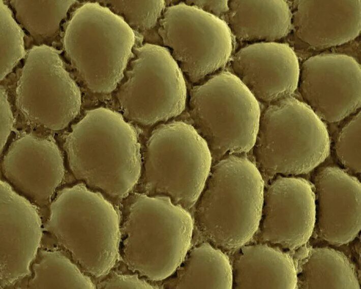 Mouse study reveals how fat 'talks' directly to the brain, and what that means f