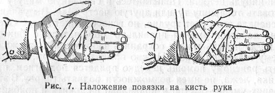 Бинтование кистей раны. Наложение повязки на руку. Наложение асептической повязки на рану