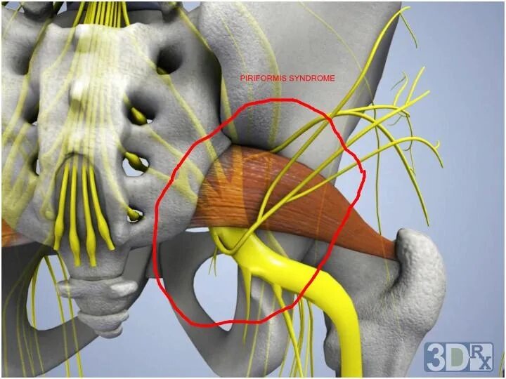 Седалищный нерв грушевидная анатомия. Седалищный нерв анатомия таз. Седалищный нерв анатомия 3д. Седалищный нерв анатомия топография.