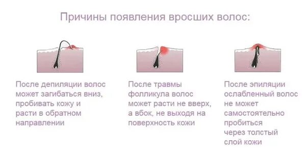 Секущиеся волосы. Причины тонкого волоса у женщины. Структура волоса. Секущиеся кончики волос причины. Волосы типы волос.