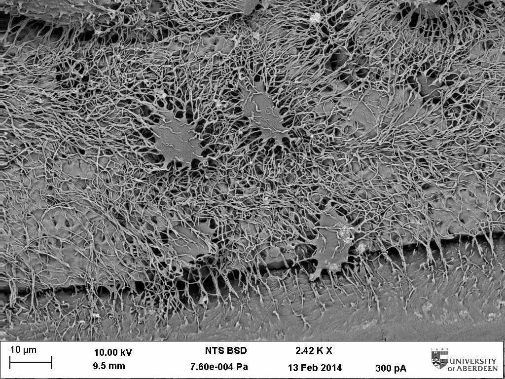 почечный клубочек электронная микроскопия. Cimex lectularius морфология. комплекс гольджи под микроскопом. на данной микрофотографии представлены. микрофотографии сканирующего электронного микроскопа.