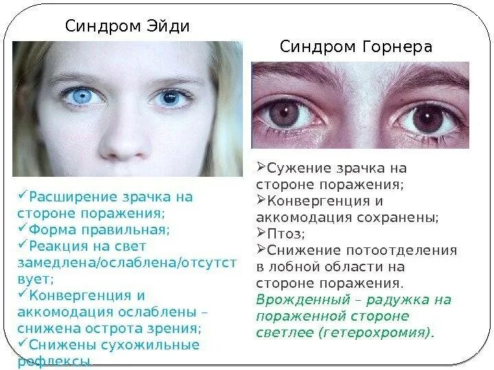 Синдром умершего
