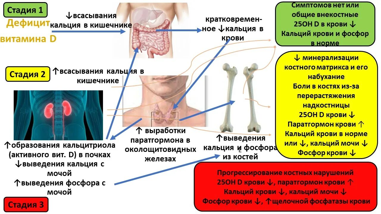 Болезни вызванные недостатком витамина д. Дефицит витамина д. Дефицит витамина d. Дефицит кальция и витамина д симптомы. Именно дефицит