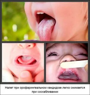 Обработать рот младенцу