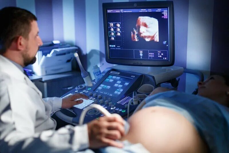 узи аппарат для пренатальной диагностики. узи беременности диагностический центр. допплерография в акушерстве. аппарат ультразвуковой диагностики. узи диагностика беременных тюмень.