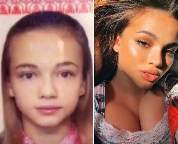 Лариса долина музыкалити. Лариса долина и валя карнавал. Губы вали карнавал до и после пластики. Валя карнавал губы до и после пластики. Музыкалити валя карнавал и лариса долина.