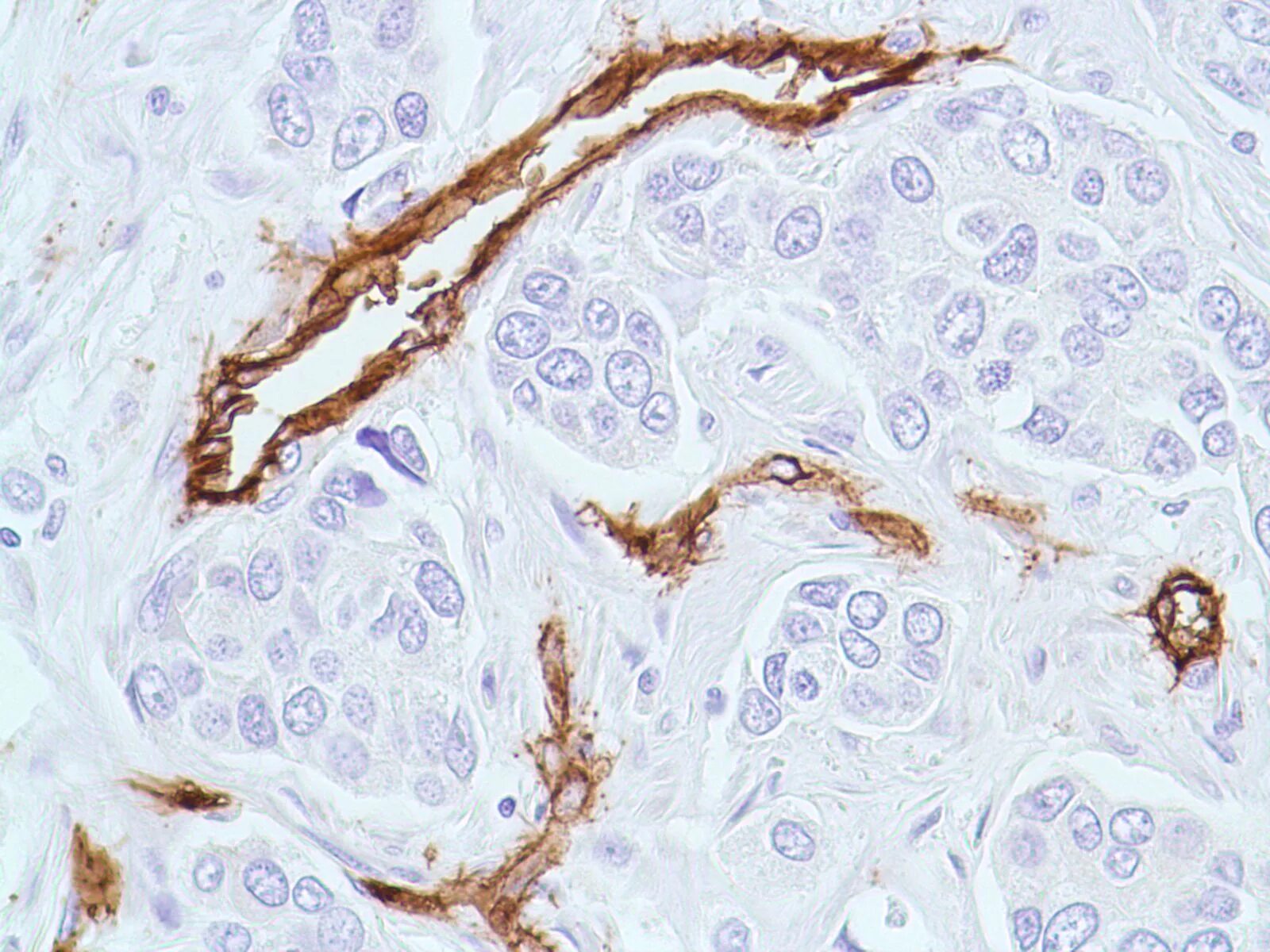 CD 34 маркер ИГХ. Cd34 иммуногистохимия. Cd34 Cell. СД 34 иммуногистохимия. Иммуногистохимические маркеры