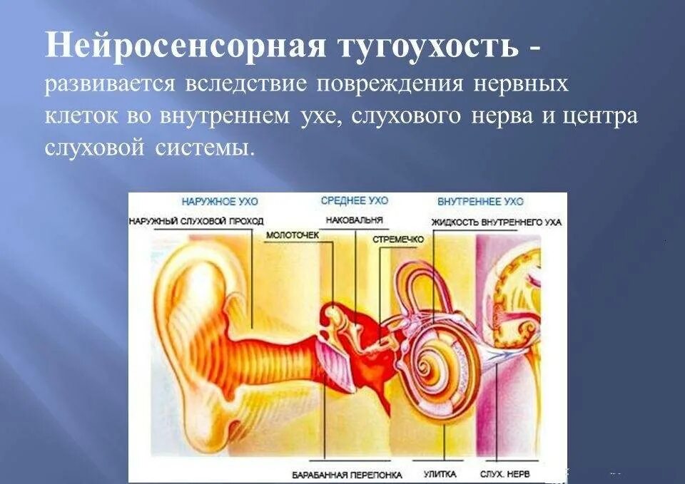 Нейросенсорная тугоухость симптомы у взрослых. Несиндромальная нейросенсорная тугоухость. механизм развития нейросенсорной тугоухости:. нарушение слуха при нейросенсорной тугоухости:. шумовая болезнь и нейросенсорная тугоухость.