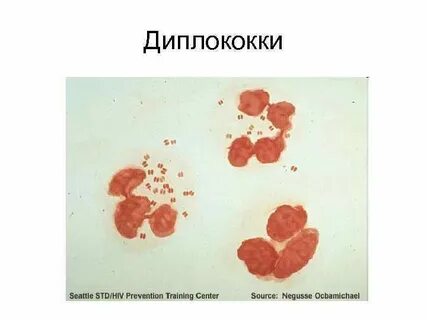 Диплококки