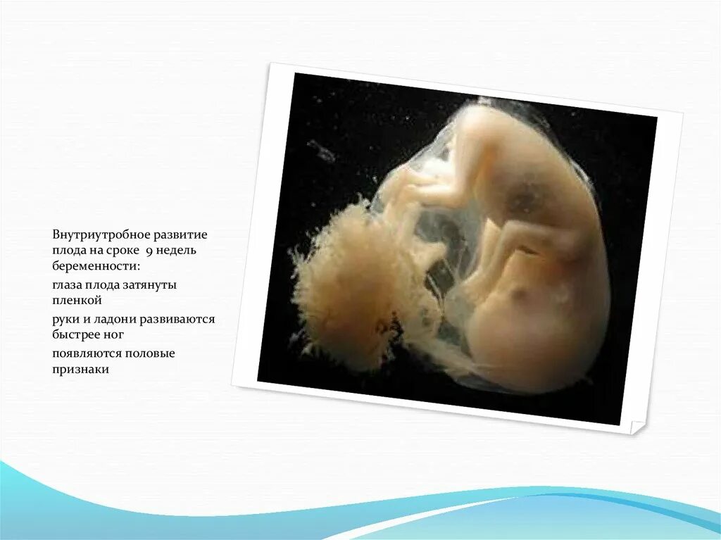 9 неделя развития плода. 9 Неделя беременности плод по неделям. Размер эмбриона на 9 неделе. Срок 8 недель беременности.