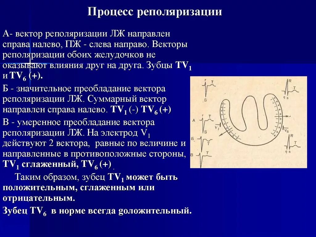 Умеренные изменения реполяризации. Реполяризация миокарда желудочков ЭКГ. Процессы реполяризации миокарда желудочков:. Реполяризация миокарда на ЭКГ диффузные изменения. Вектор реполяризации направлен.