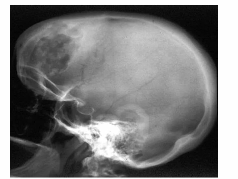 Томография коленного сустава. Кт брюшной полости аппарат. Компьютерная томография костей таза. Как делают кт костей. Компьютерная томография костей аппарат.