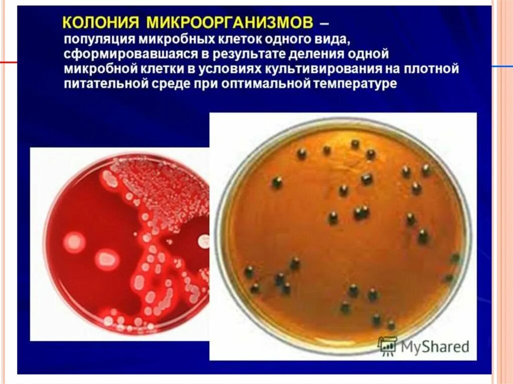 Экспериментатор решила установить какое количество бактерий. Колония это микробиология. Колонии микроорганизмов. Колония микроорганизмов это микробиология. Колония бактерий это в микробиологии.